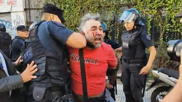 La Policía hirió y detuvo a un camarógrafo de A24 frente al Congreso